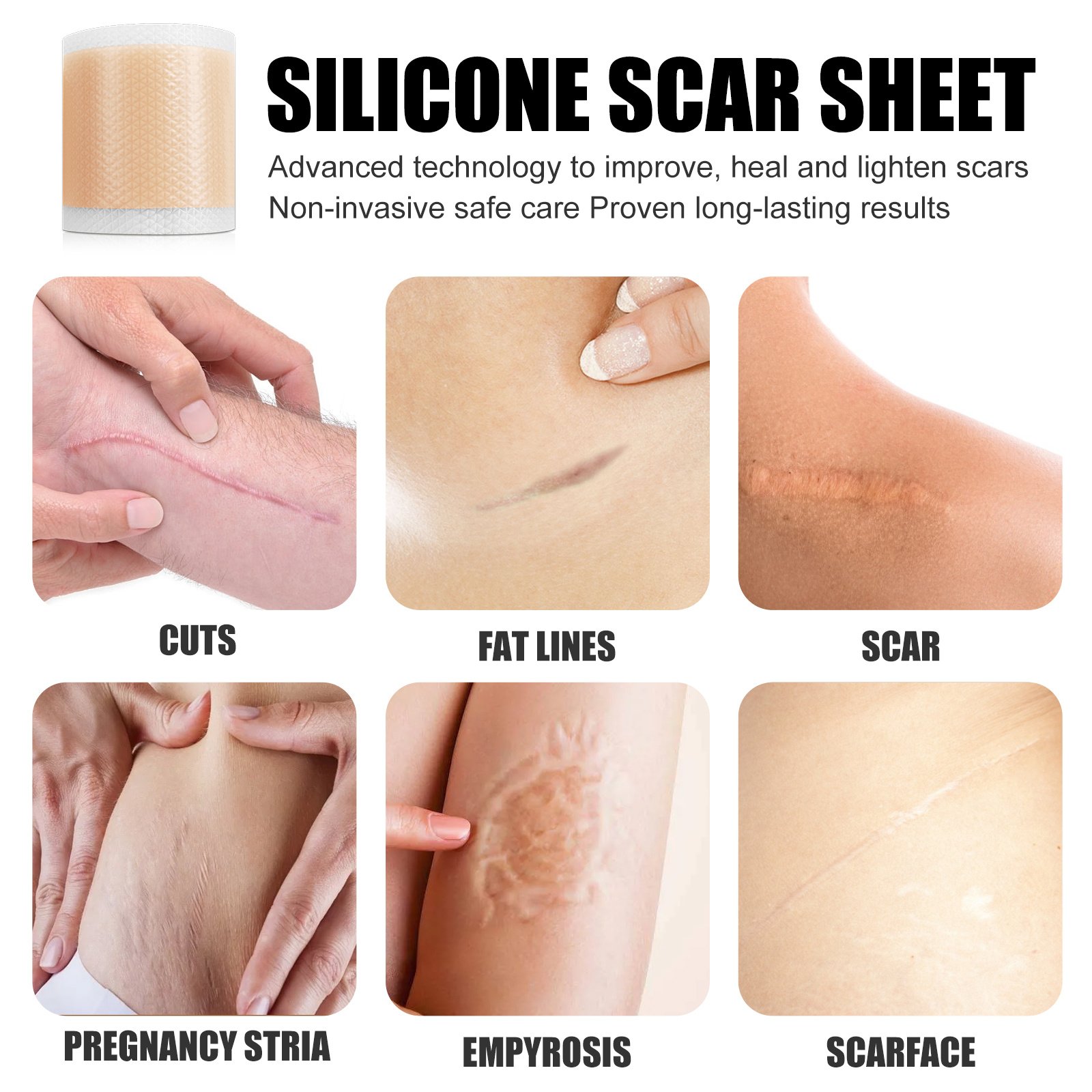 Self-Adhesive Silicone Scar Repair Orange Line Growth Line Smooth Skin Care Beauty Patch - Image 5